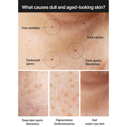 ELSY Dark Spot Brightening Cream